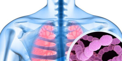 Pneumococco
