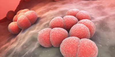 Meningococco (Neisseria Meningitidis)